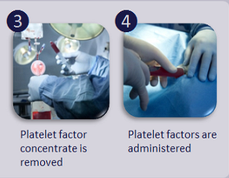 Platelet therapy is definitely an option for dogs suffering from osteoarthritis, or a tendon or ligament injury